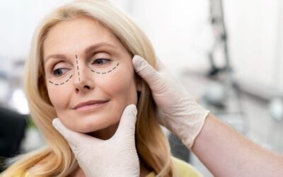 Upper Eyelid Surgery (Blepharoplasty): The Complete Guide