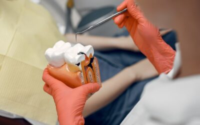 Comparing Dental Restorations in Turkey: Inlays, Onlays, and Crowns