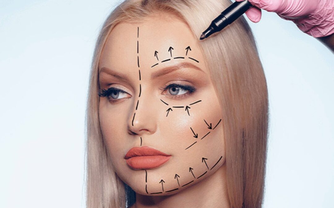 Liposuction Isn’t Just for the Belly: Explore Face Slimming with Buccal Fat Removal