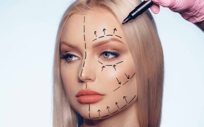 Liposuction Isn’t Just for the Belly: Explore Face Slimming with Buccal Fat Removal