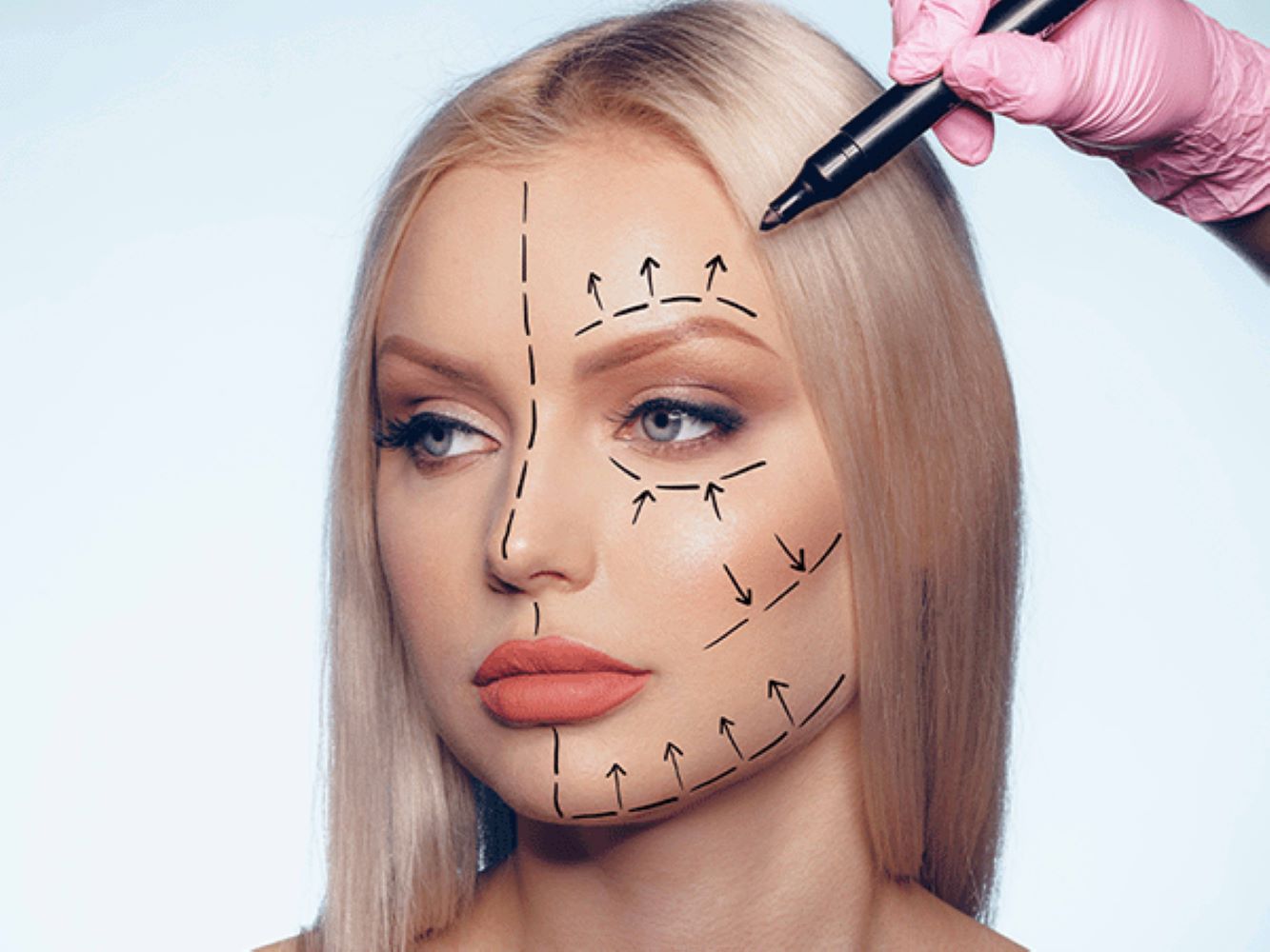 Liposuction