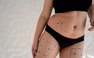 The Gut-Skin Axis: Unlocking Radiant Skin Through Gut Health