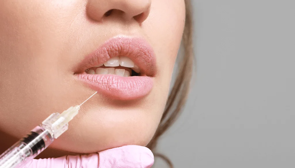 Lip Filler Swelling Stages