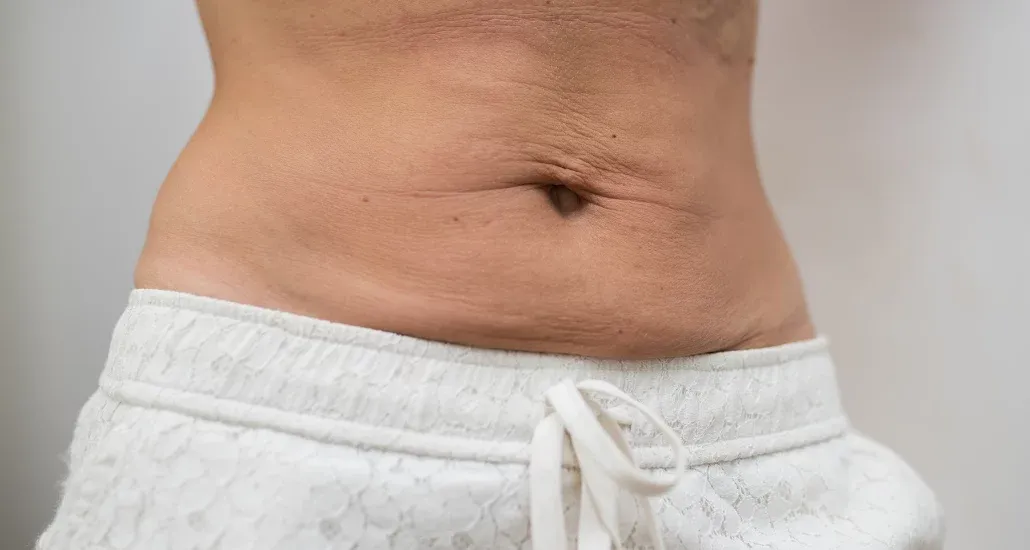  skin tightening treatments