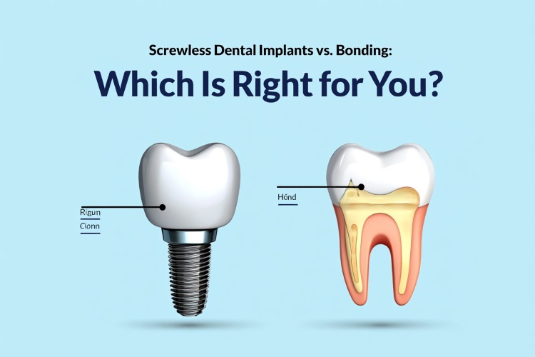 Screwless Dental Implants vs. Bonding