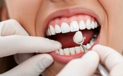 Front Dental Implants Guide