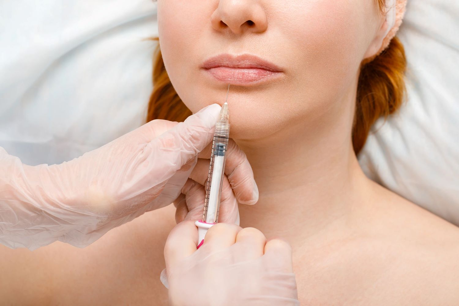 lip filler side effects