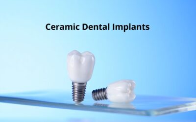 Ceramic Dental Implants: A Metal-Free, Natural-Looking Tooth Replacement