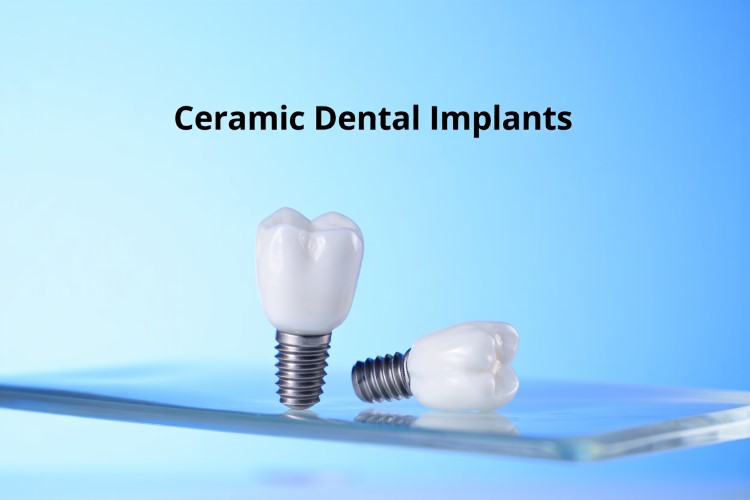 Ceramic Dental Implants