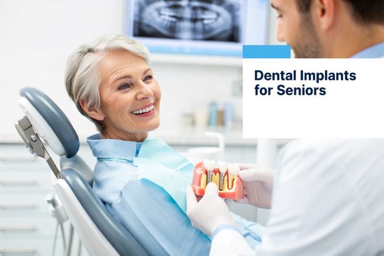 Dental Implants for Seniors – A Comprehensive Guide