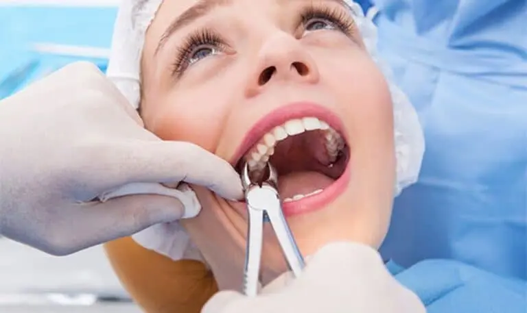 Root Canal vs Tooth Extraction Pros and Cons