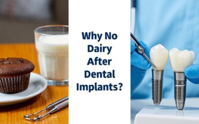 Why No Dairy After Dental Implant? Here’s What You Should Know