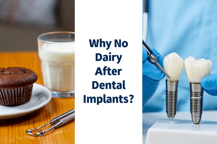 Why No Dairy After Dental Implants