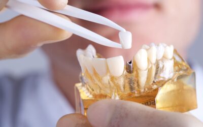 Dental Implant Crown in Turkey: Restore Your Smile with Confidence