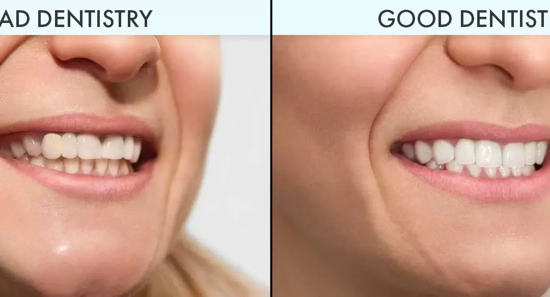 Understanding the Most Common Dental Implant Issues