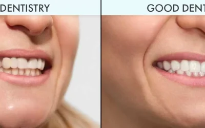 Understanding the Most Common Dental Implant Issues