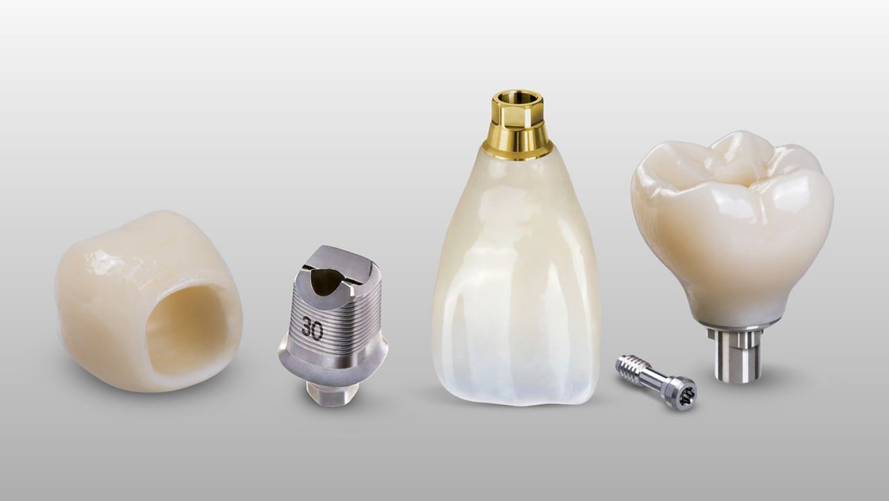 Screw-Retained Implant Crowns