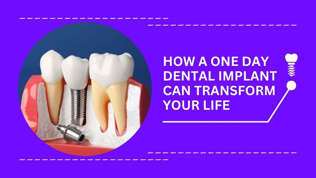 Same Day Dental Implants: Everything You Need to Know