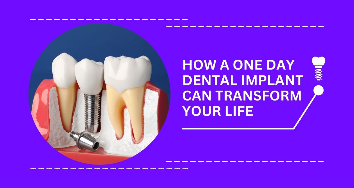 same day dental implants