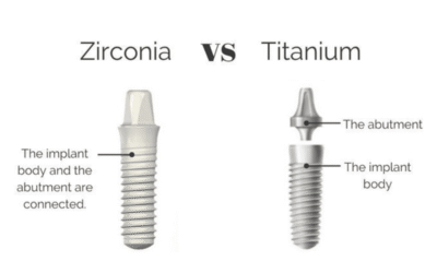 Dental Implants Zirconia vs Titanium: A Complete Guide to Choosing the Right Material