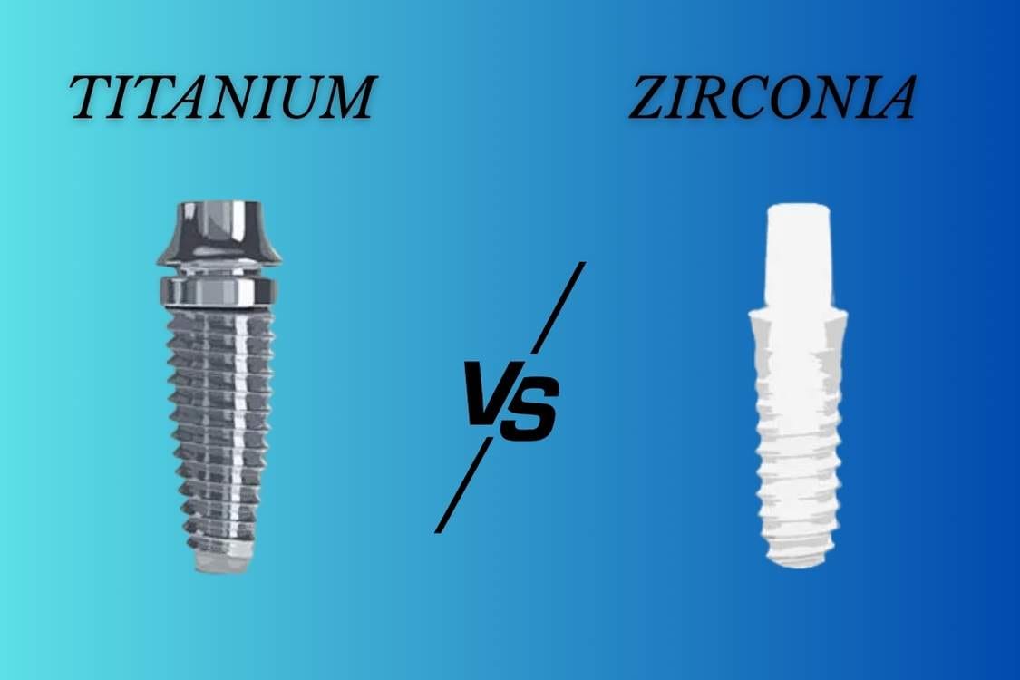 Zirconia Implants Cost