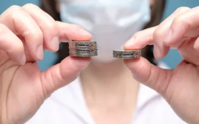 Cost of Dental Implants in Turkey vs USA: The Ultimate Price Guide for Smart Patients