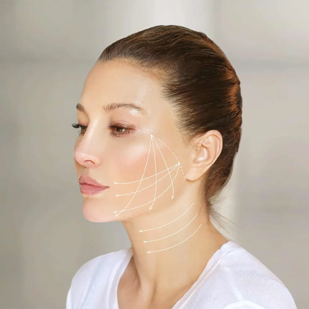 What Is Bichektomie ?