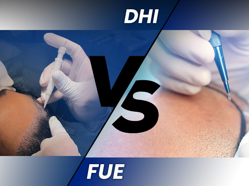 FUE-vs-DHI-Hair procedure in Turkey
