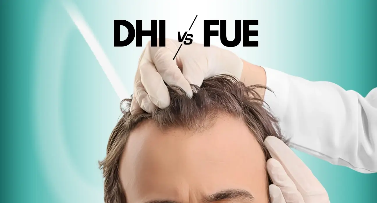 dhi-vs-fue-estetik-international DHI vs FUE Hair Transplant