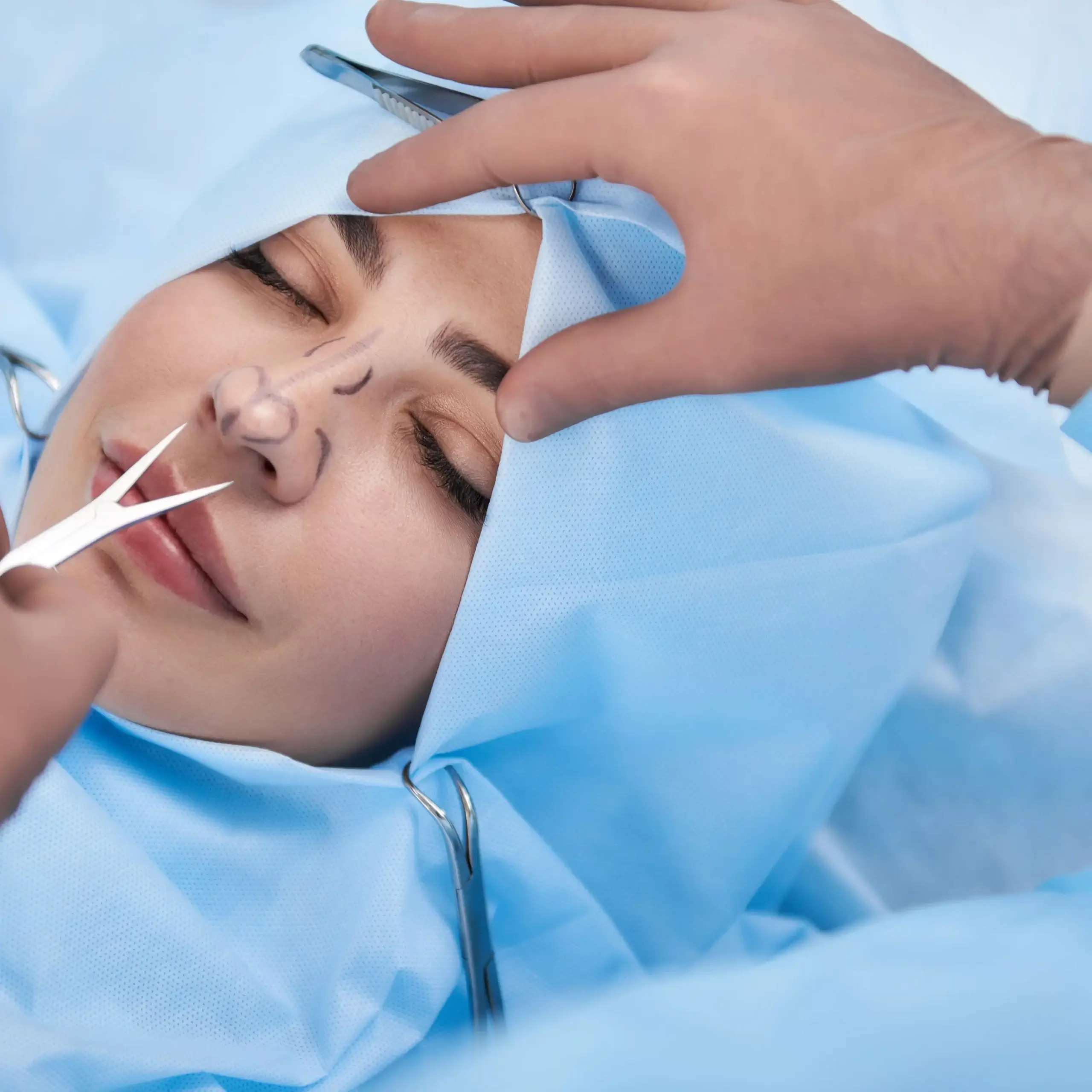 What is a tip rhinoplasty ? 